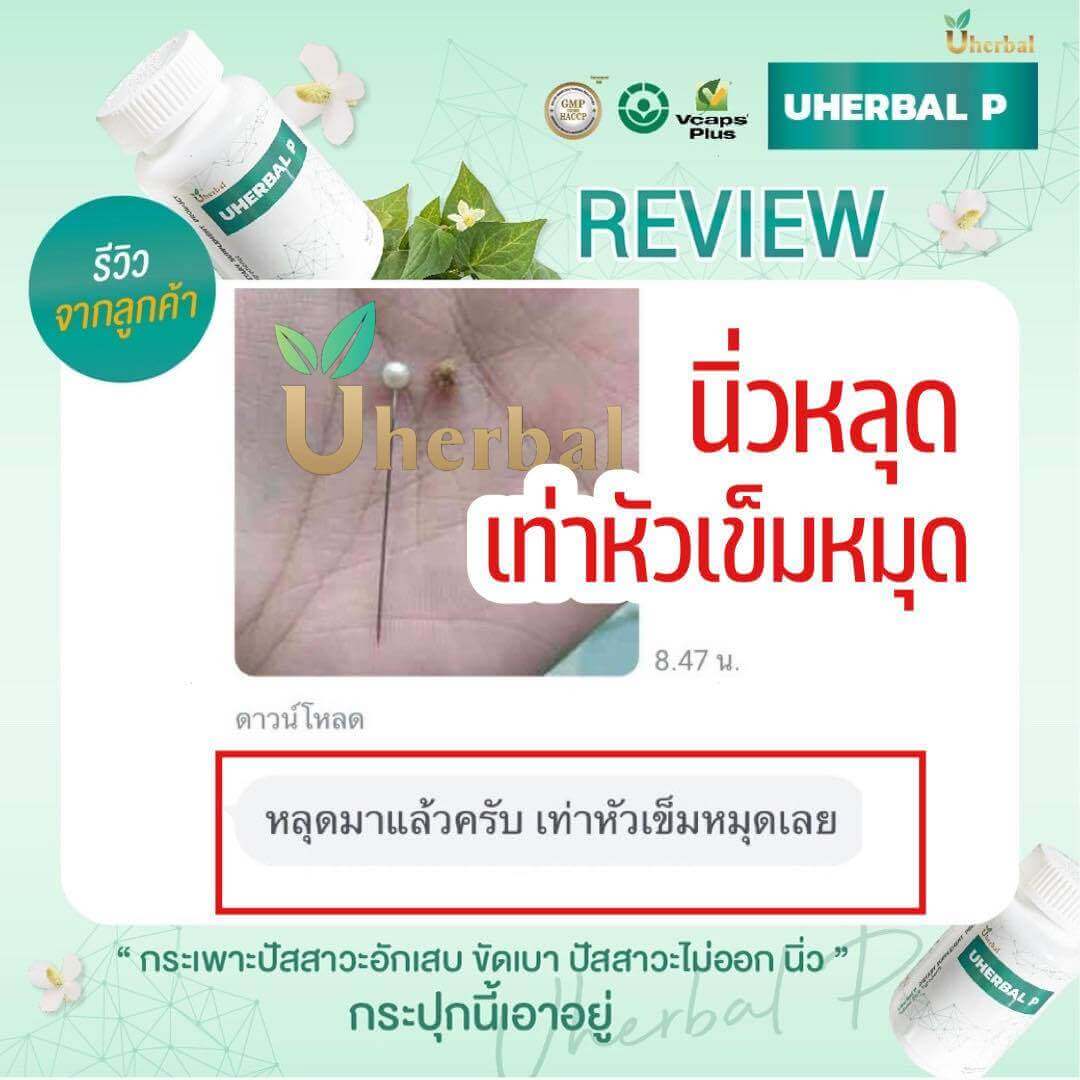 Uherbal, ยูเฮอร์เบิล, นิ่วในไต, นิ่วในกระเพาะปัสสาวะ, กระเพาะปัสสวาะอัก้เสบ, ปัสสววะบ่อย, ฉี่บ่อย, สล่ายนิ่ว, ปัสสาวะขัด, ปัสสาวะไม่พุง, ฉี่ไม่สุด, ฉี่กระปริบกระปรอย, ปวดเอว, ปวดหลัง, ขับนิ่ว, ฉี่เป็นเลือด, ต่อมลูกหมากโต, ฉี่เหลือง, ปัสสาวะแสบ, ปัสสาวะฉุน, ฉี่ไม่พุ่ง
